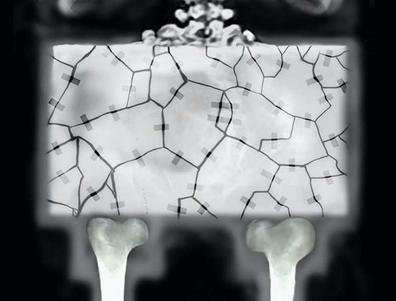 File:I Had an Accident 037.png